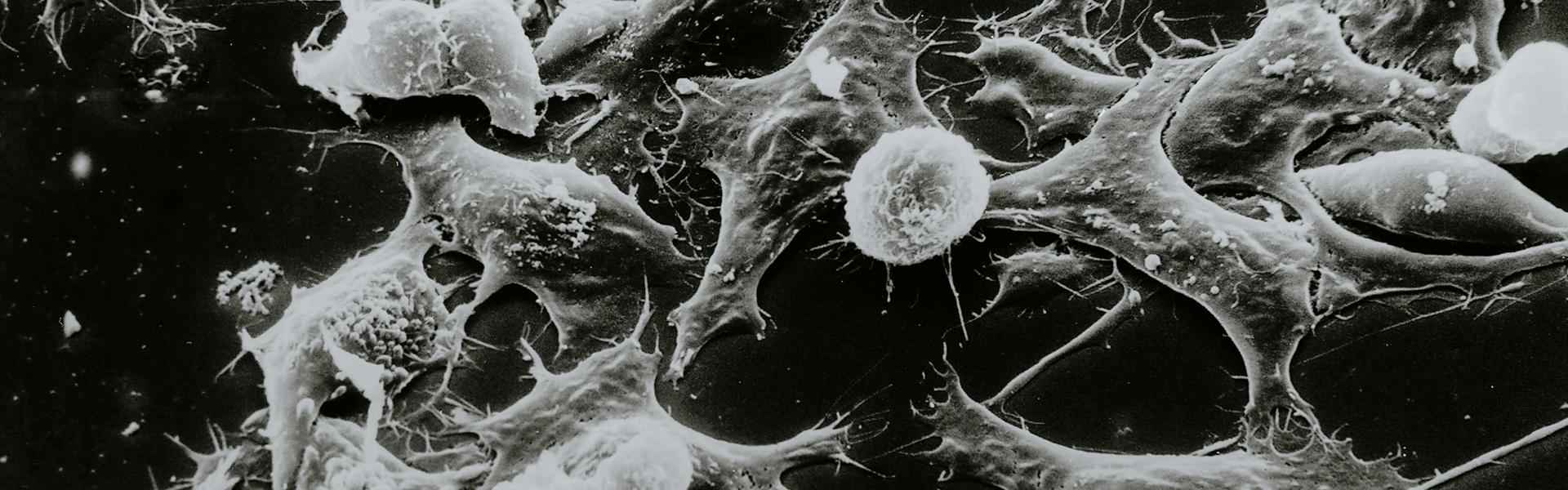 肿瘤免疫相关靶点MICA/B成药策略及研究