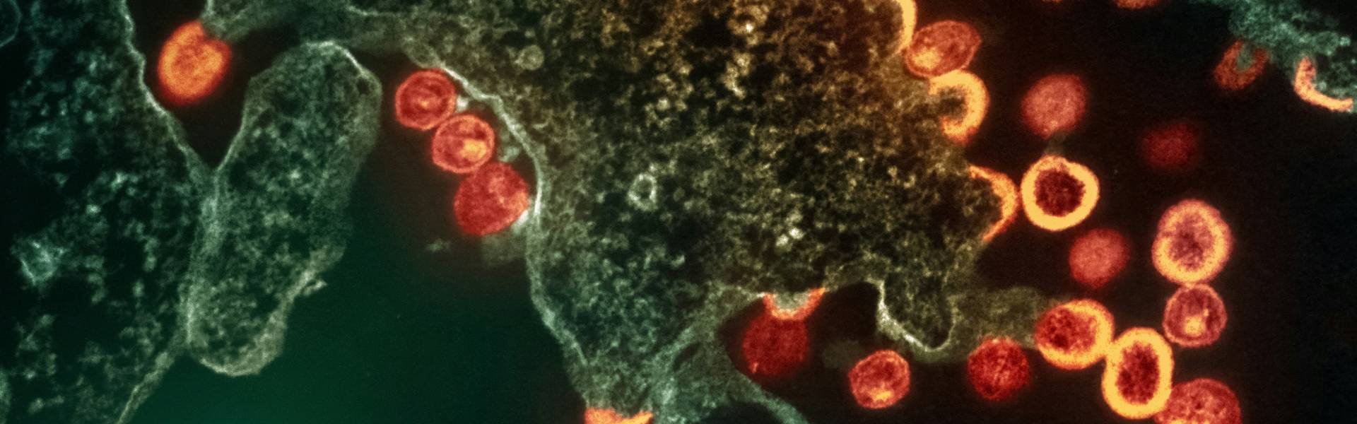 攻克HIV曙光已来？