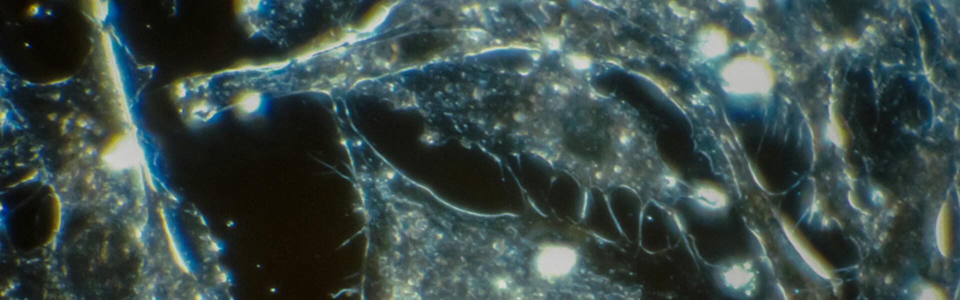 CXCR4：一个多应用领域的重要趋化因子受体