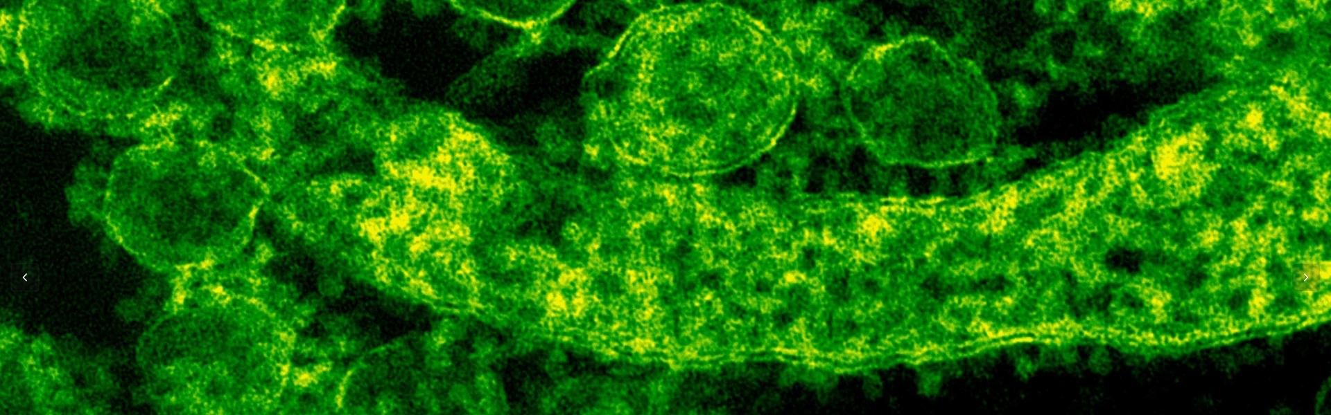 这种病毒竟有抗癌的作用？