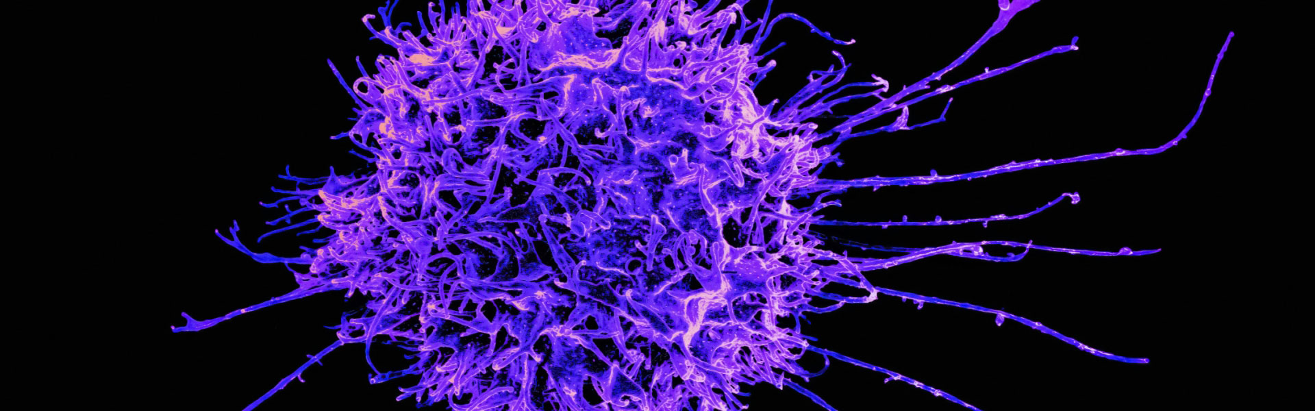 基于纳米抗体的IL-2靶向治疗研究与应用潜力