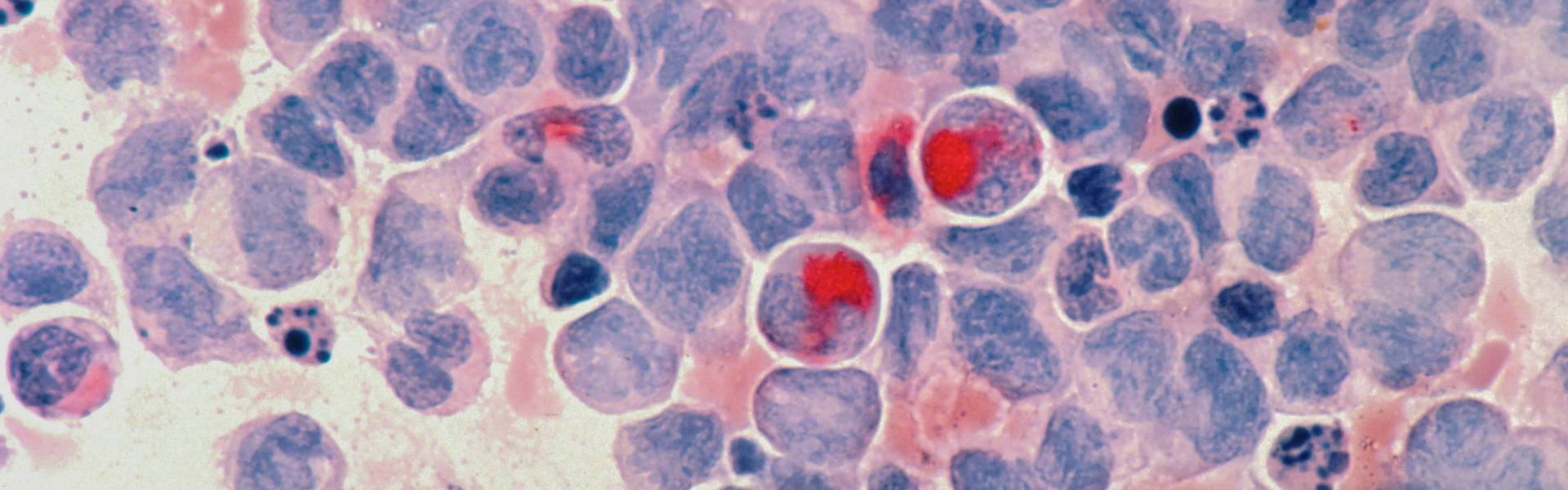 纳博生命CD19免疫文库：助力B细胞相关疾病药物研究