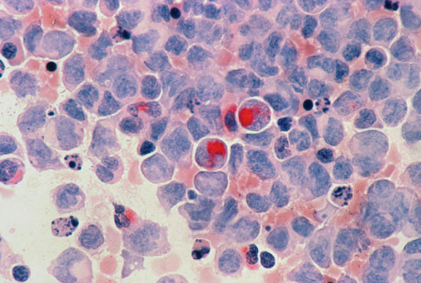 纳米抗体：揭秘TRIB2蛋白的激活态，解锁白血病治疗新路径