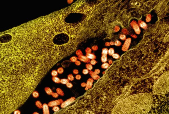 纳米抗体&VSV-G协同增效靶向HER2阳性的肿瘤治疗