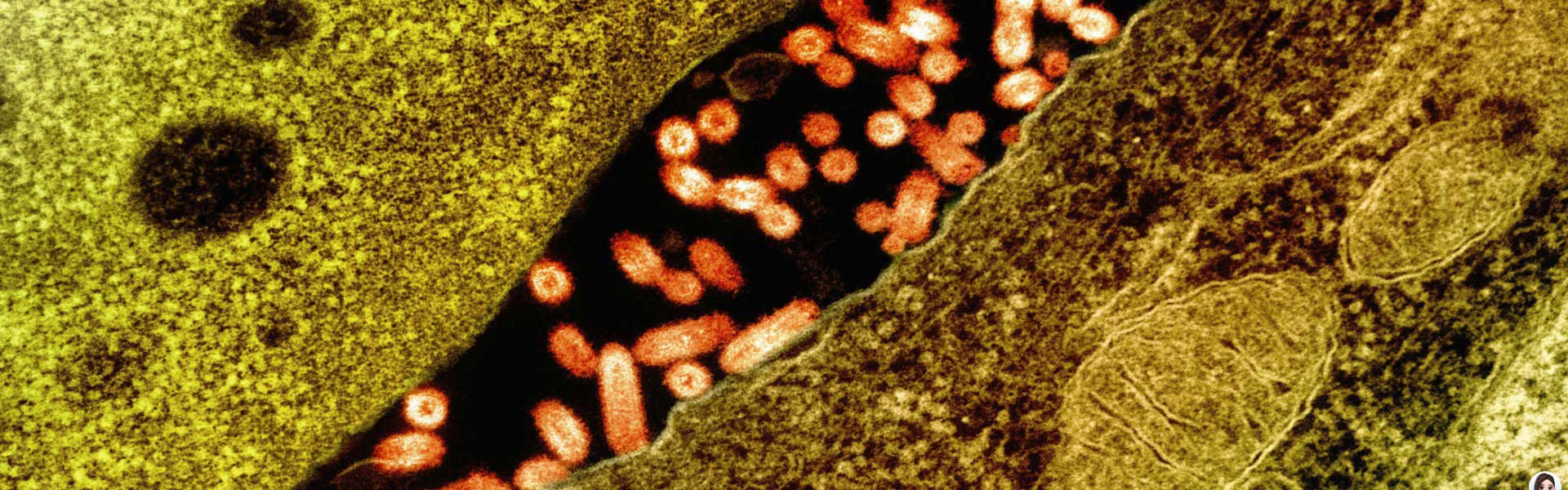 纳米抗体&VSV-G协同增效靶向HER2阳性的肿瘤治疗