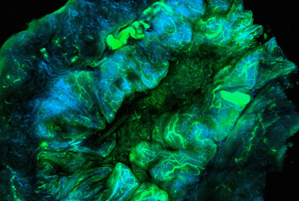 突破 “不可成药” 壁垒！纳米抗体PROTAC为YAP依赖性癌症带来新疗法