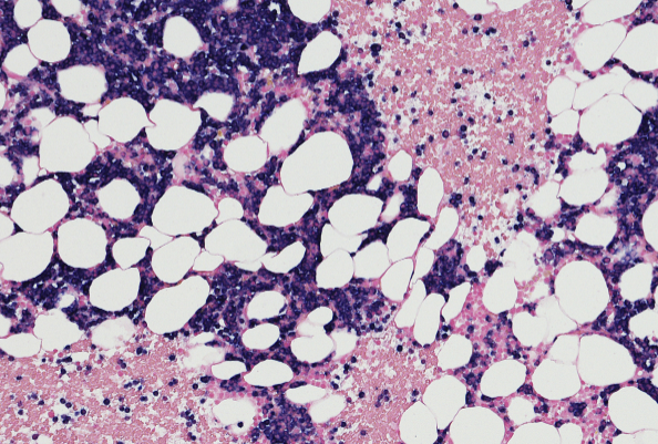 纳米抗体赋能创新药！JSKN016 III期临床首例患者给药